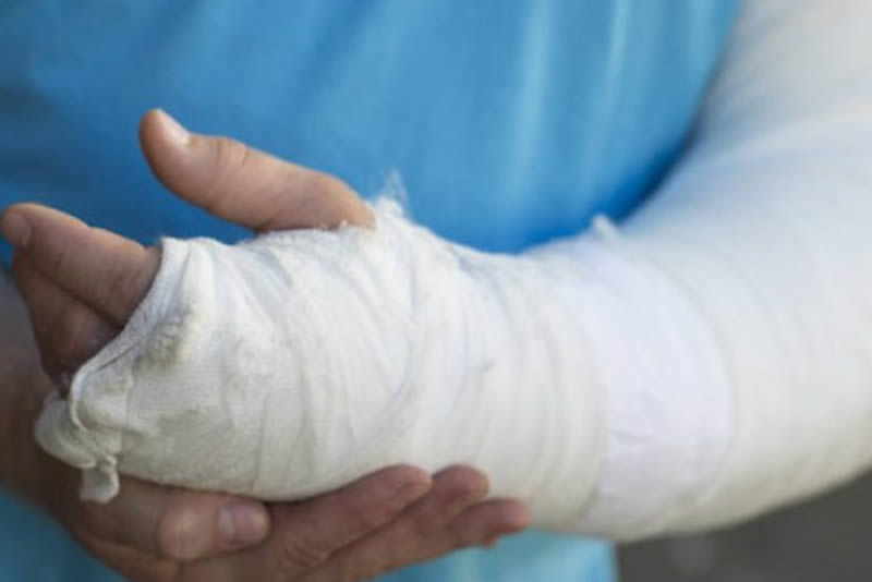 Сколько страховка при переломе руки